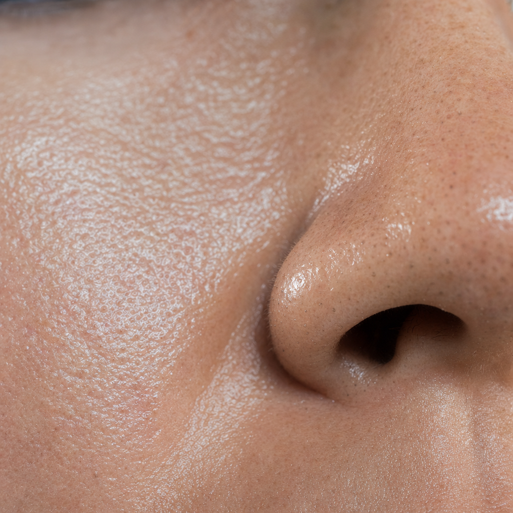 Peau grasse : sébum, brillance et pores dilatés
